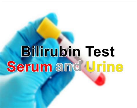 bilirubina 1 in urina|Bilirubin In Urine: Causes And What It Indicates 